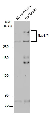 Western blot - Anti-Nav1.7 antibody (AB272931)