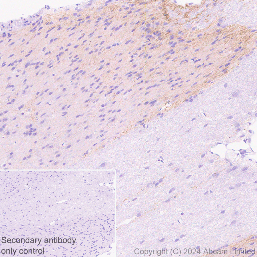 Immunohistochemistry (Formalin/PFA-fixed paraffin-embedded sections) - Anti-Nav1.7 antibody [EPR26246-318] (ab323849), expandable thumbnail