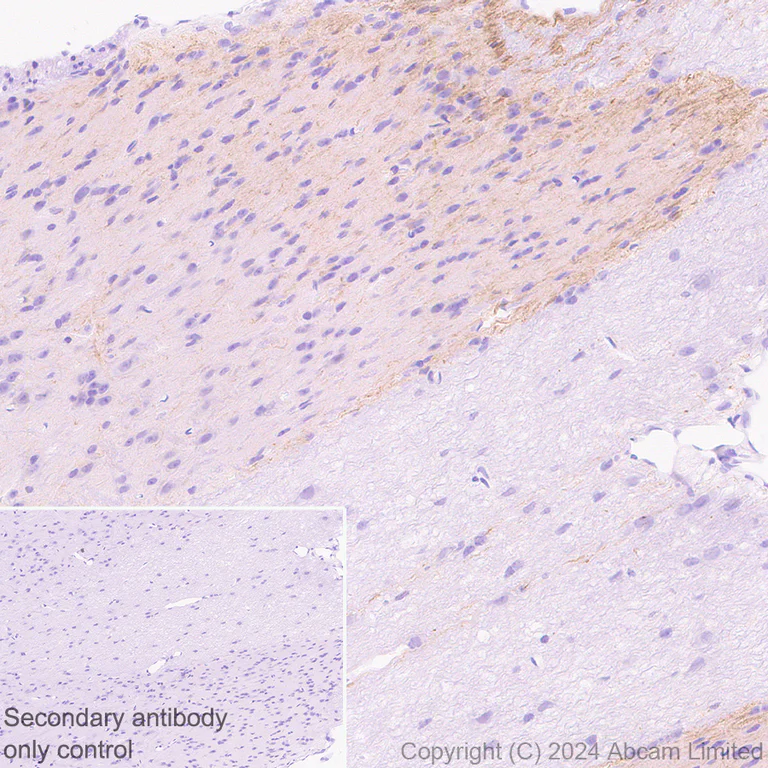 Immunohistochemistry (Formalin/PFA-fixed paraffin-embedded sections) - Anti-Nav1.7 antibody [EPR26246-318] (AB323849)