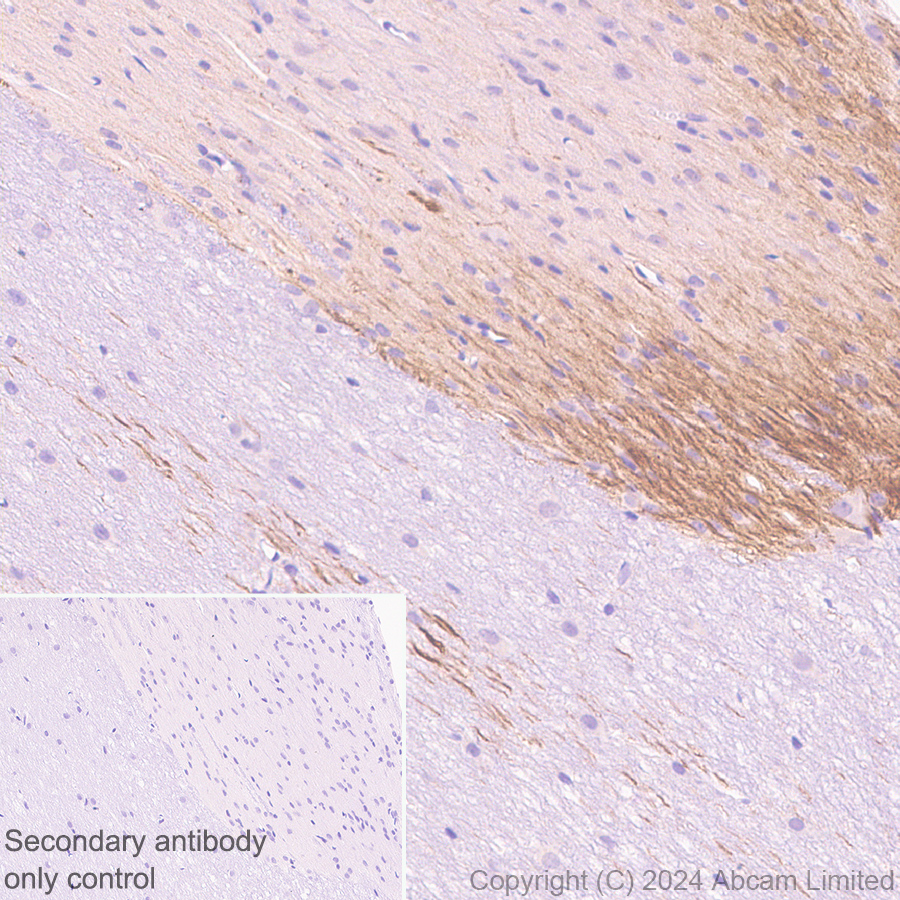 Immunohistochemistry (Formalin/PFA-fixed paraffin-embedded sections) - Anti-Nav1.7 antibody [EPR26246-318] (AB323849), expandable thumbnail