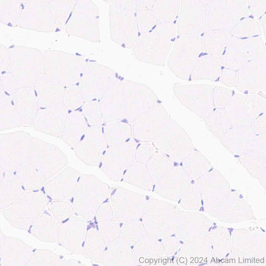 Immunohistochemistry (Formalin/PFA-fixed paraffin-embedded sections) - Anti-Nav1.7 antibody [EPR26246-318] (AB323849), expandable thumbnail