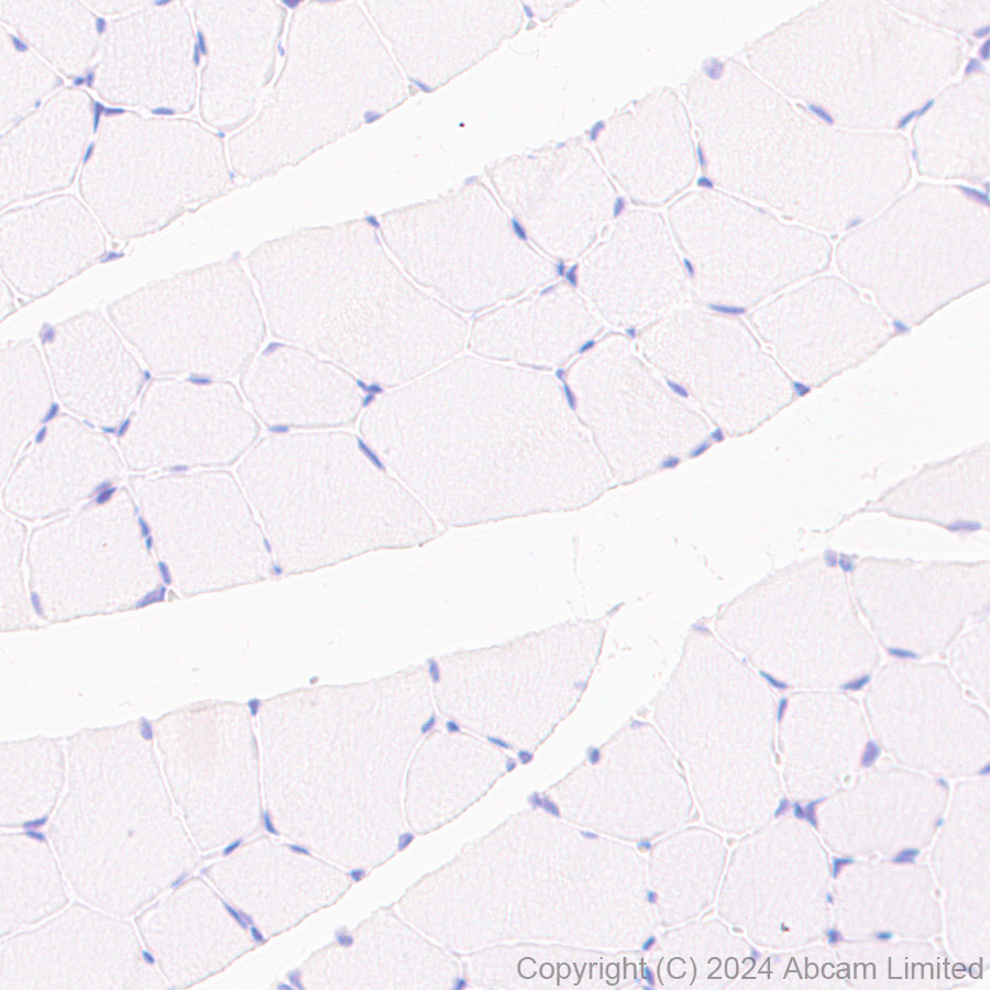 Immunohistochemistry (Formalin/PFA-fixed paraffin-embedded sections) - Anti-Nav1.7 antibody [EPR26246-318] (ab323849), expandable thumbnail