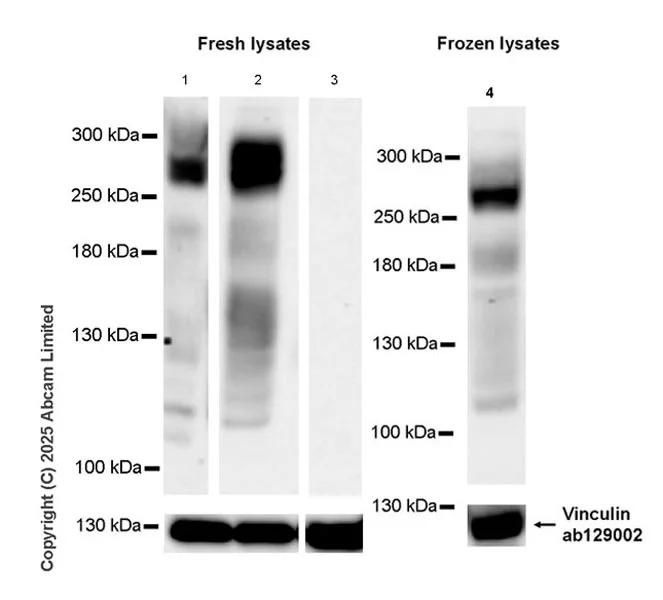 Western blot - Anti-Nav1.7 antibody [EPR26246-318] (AB323849)