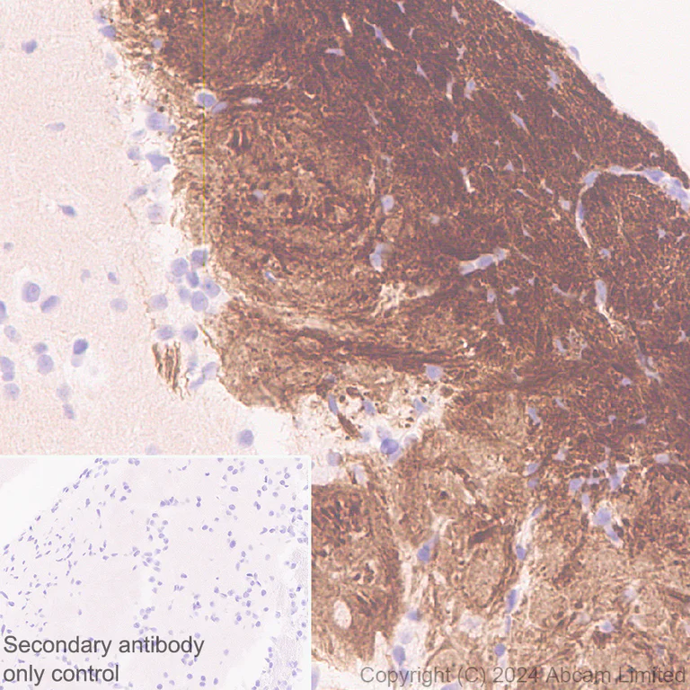 Immunohistochemistry (Formalin/PFA-fixed paraffin-embedded sections) - Anti-Nav1.7 antibody [EPR26246-318] - BSA and Azide free (AB325967)