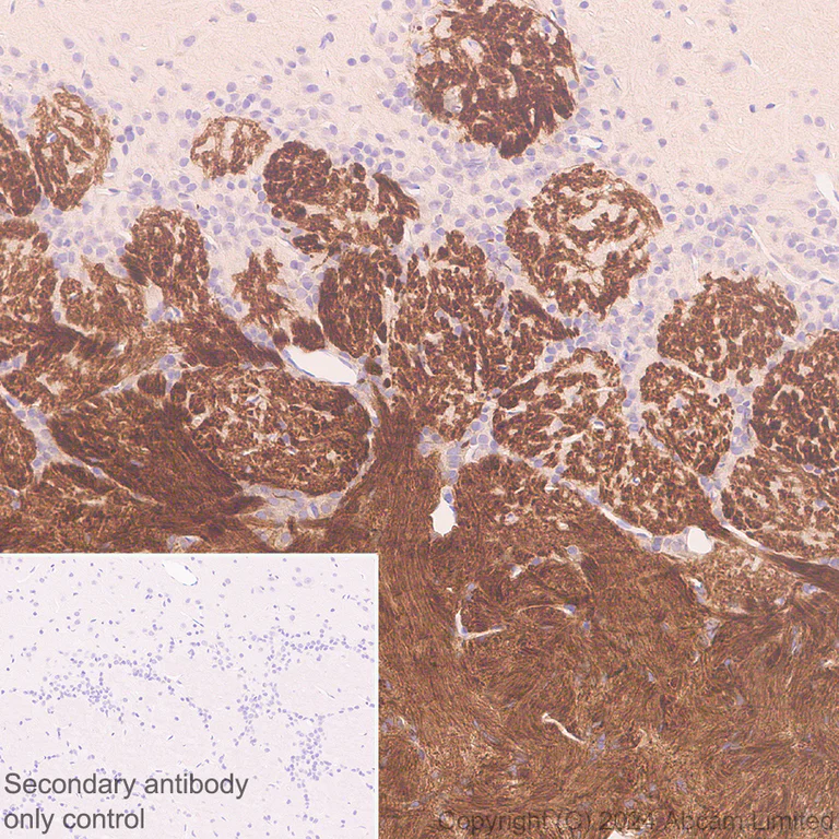 Immunohistochemistry (Formalin/PFA-fixed paraffin-embedded sections) - Anti-Nav1.7 antibody [EPR26246-318] - BSA and Azide free (AB325967)
