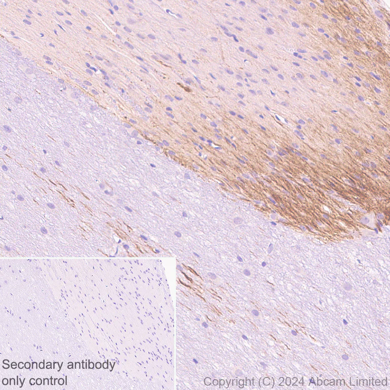 Immunohistochemistry (Formalin/PFA-fixed paraffin-embedded sections) - Anti-Nav1.7 antibody [EPR26246-318] - BSA and Azide free (AB325967)