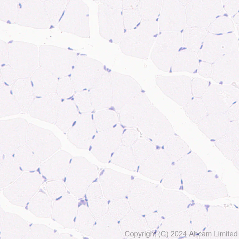 Immunohistochemistry (Formalin/PFA-fixed paraffin-embedded sections) - Anti-Nav1.7 antibody [EPR26246-318] - BSA and Azide free (AB325967)