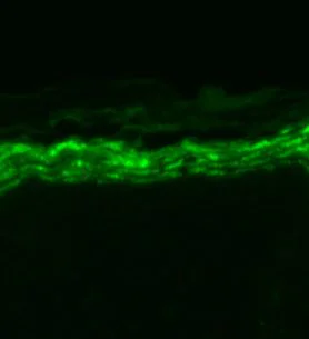 Immunohistochemistry (Formalin/PFA-fixed paraffin-embedded sections) - Anti-Nav1.7 antibody [N68/6] (AB85015)