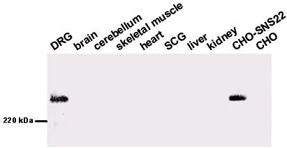 Western blot - Anti-Nav1.8/SCN10A antibody (AB63331)