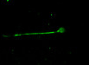 Immunocytochemistry - Anti-Nav1.8/SCN10A antibody (AB66743), expandable thumbnail