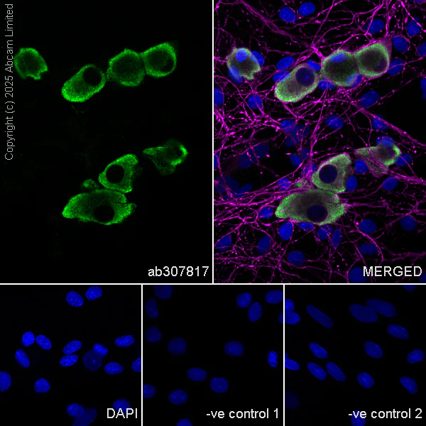 Immunocytochemistry/ Immunofluorescence - Anti-Nav1.8/SCN10A antibody [EPR25132-222] (AB307817)