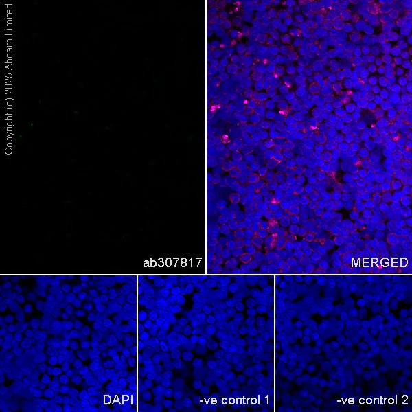 Immunocytochemistry/ Immunofluorescence - Anti-Nav1.8/SCN10A antibody [EPR25132-222] (AB307817)