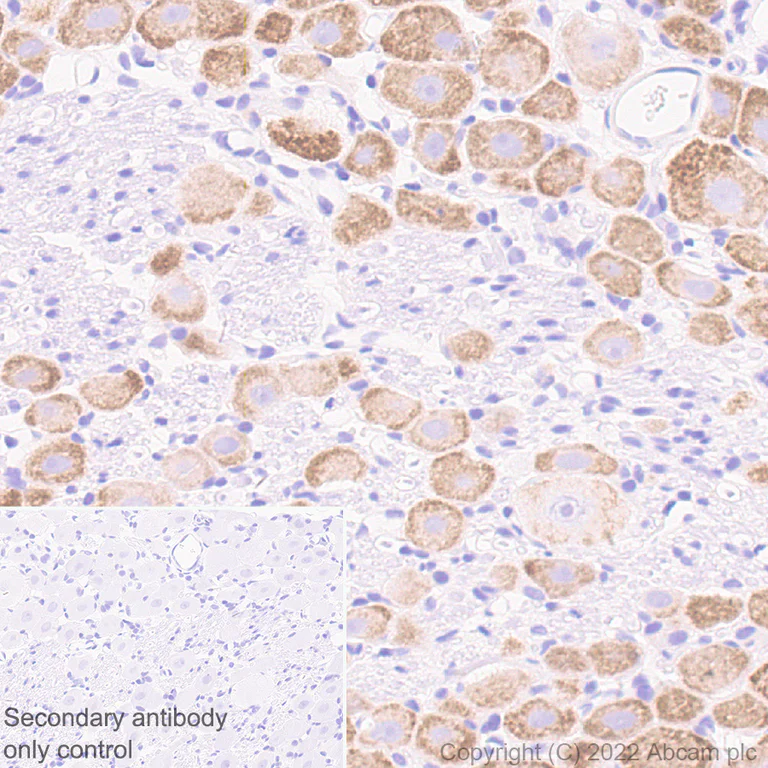 Immunohistochemistry (Formalin/PFA-fixed paraffin-embedded sections) - Anti-Nav1.8/SCN10A antibody [EPR25132-222] (AB307817)