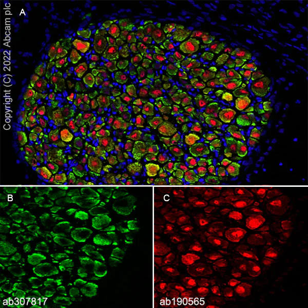 Immunohistochemistry (Frozen sections) - Anti-Nav1.8/SCN10A antibody [EPR25132-222] (AB307817)