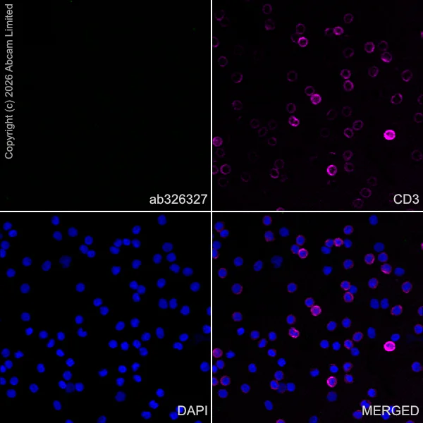 Immunocytochemistry/ Immunofluorescence - Anti-Nav1.8/SCN10A antibody [EPR30868-73] (AB326327)