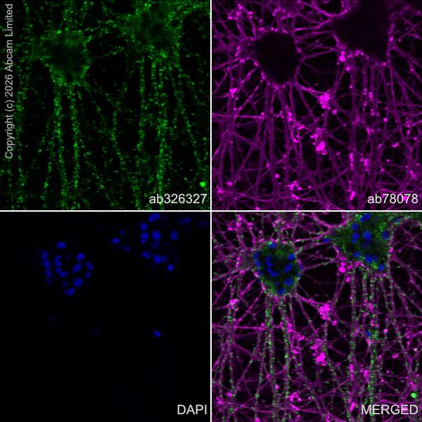 Immunocytochemistry/ Immunofluorescence - Anti-Nav1.8/SCN10A antibody [EPR30868-73] (AB326327)
