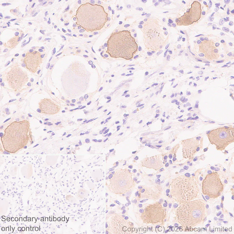 Immunohistochemistry (Formalin/PFA-fixed paraffin-embedded sections) - Anti-Nav1.8/SCN10A antibody [EPR30868-73] (AB326327)
