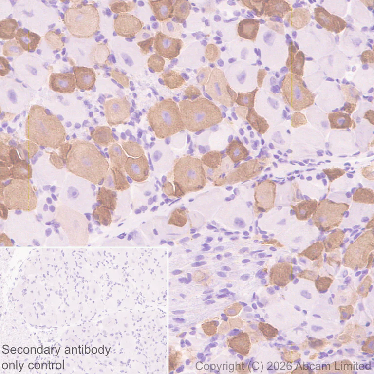 Immunohistochemistry (Formalin/PFA-fixed paraffin-embedded sections) - Anti-Nav1.8/SCN10A antibody [EPR30868-73] (AB326327)