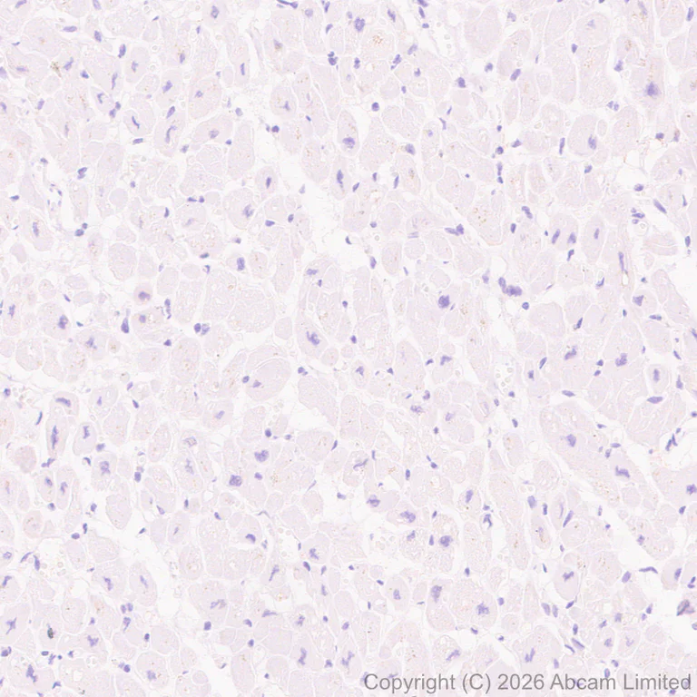 Immunohistochemistry (Formalin/PFA-fixed paraffin-embedded sections) - Anti-Nav1.8/SCN10A antibody [EPR30868-73] (AB326327)