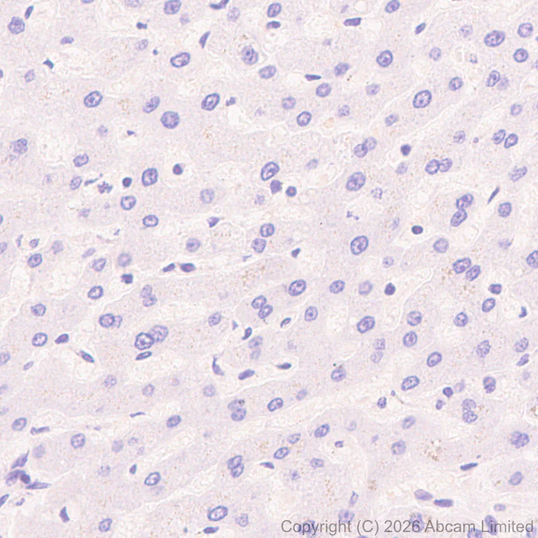 Immunohistochemistry (Formalin/PFA-fixed paraffin-embedded sections) - Anti-Nav1.8/SCN10A antibody [EPR30868-73] (AB326327)