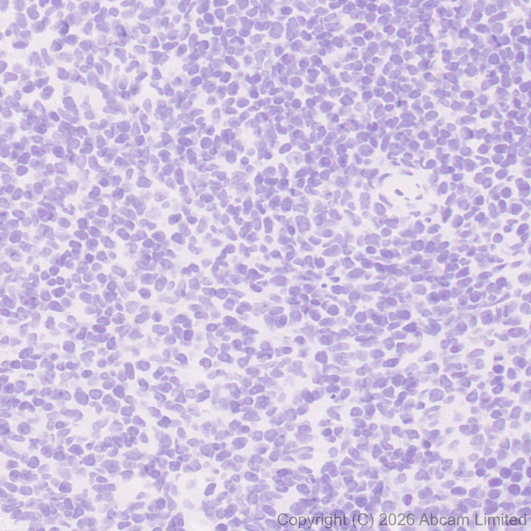 Immunohistochemistry (Formalin/PFA-fixed paraffin-embedded sections) - Anti-Nav1.8/SCN10A antibody [EPR30868-73] (AB326327)