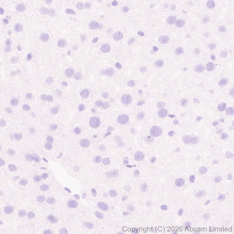 Immunohistochemistry (Formalin/PFA-fixed paraffin-embedded sections) - Anti-Nav1.8/SCN10A antibody [EPR30868-73] (AB326327)