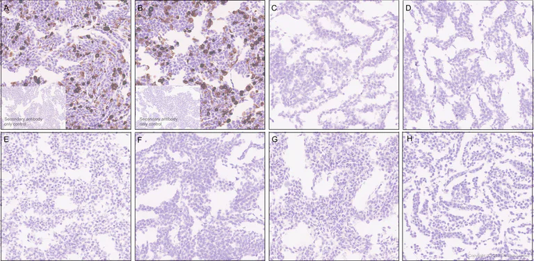Immunohistochemistry (Formalin/PFA-fixed paraffin-embedded sections) - Anti-Nav1.8/SCN10A antibody [EPR30868-73] (AB326327)