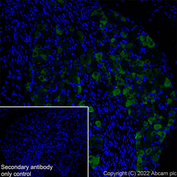 Immunohistochemistry (Frozen sections) - Anti-Nav1.8/SCN10A antibody [S134] (AB93616)