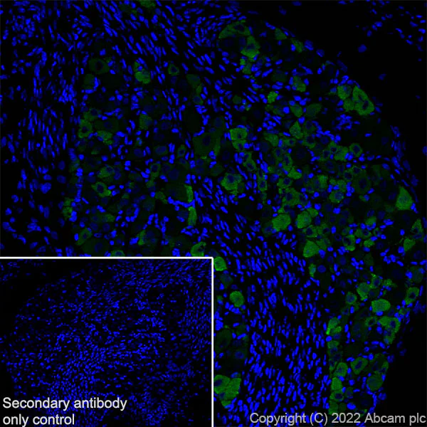Immunohistochemistry (Frozen sections) - Anti-Nav1.8/SCN10A antibody [S134] (AB93616)