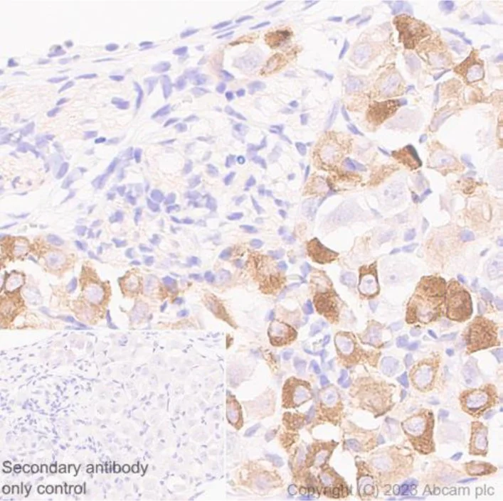 Immunohistochemistry (Formalin/PFA-fixed paraffin-embedded sections) - Anti-Nav1.8/SCN10A antibody [S134] - BSA and Azide free (AB309153)
