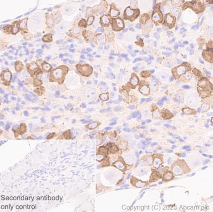 Immunohistochemistry (Formalin/PFA-fixed paraffin-embedded sections) - Anti-Nav1.8/SCN10A antibody [S134] - BSA and Azide free (AB309153)