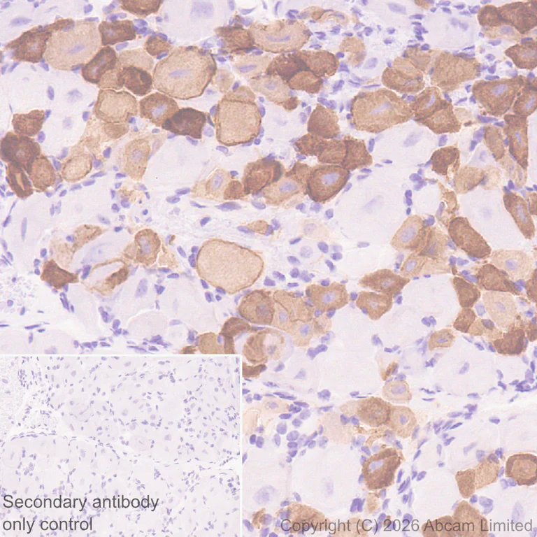 Immunohistochemistry (Formalin/PFA-fixed paraffin-embedded sections) - Anti-Nav1.8/SCN10A (C-terminal) antibody [EPR30868-550] (AB326328)