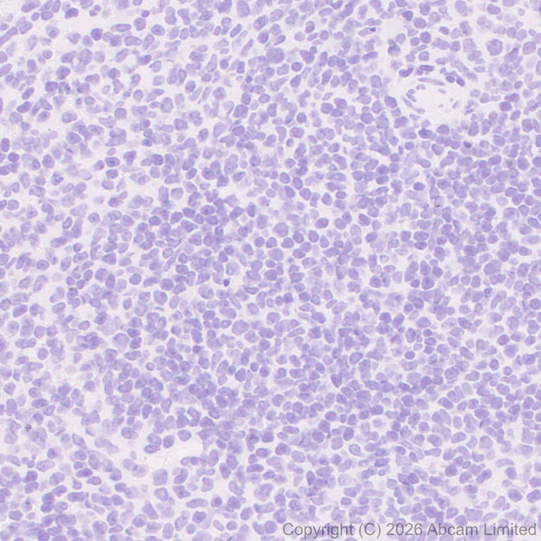 Immunohistochemistry (Formalin/PFA-fixed paraffin-embedded sections) - Anti-Nav1.8/SCN10A (C-terminal) antibody [EPR30868-550] (AB326328)