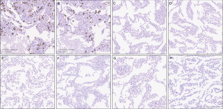 Immunohistochemistry (Formalin/PFA-fixed paraffin-embedded sections) - Anti-Nav1.8/SCN10A (C-terminal) antibody [EPR30868-550] (AB326328)