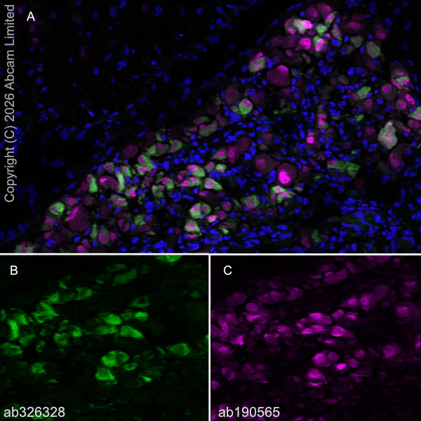 Immunohistochemistry (Frozen sections) - Anti-Nav1.8/SCN10A (C-terminal) antibody [EPR30868-550] (AB326328)