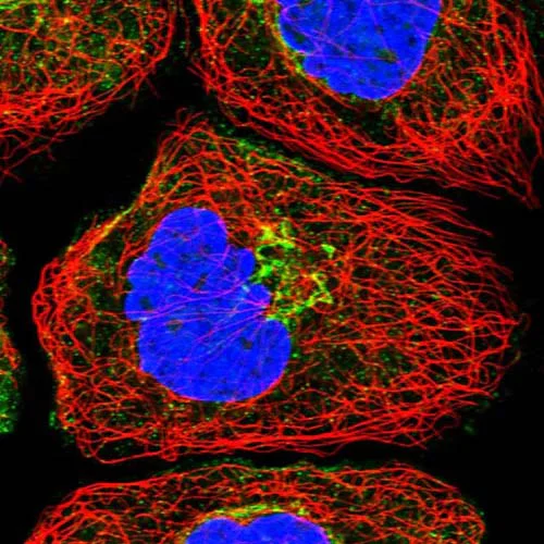 Immunocytochemistry/ Immunofluorescence - Anti-NBAS antibody (AB122370)