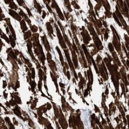 Immunohistochemistry (Formalin/PFA-fixed paraffin-embedded sections) - Anti-NBAS antibody (AB122370)