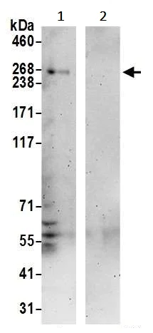 Immunoprecipitation - Anti-NBAS antibody (AB242220)