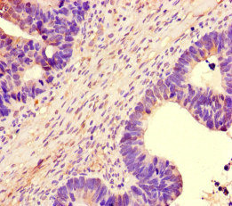 Immunohistochemistry (Formalin/PFA-fixed paraffin-embedded sections) - Anti-NBEAL2 antibody (AB234725)