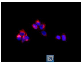 Immunocytochemistry/ Immunofluorescence - Anti-NBL1 antibody [EPR12397] (AB174843), expandable thumbnail