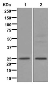 Western blot - Anti-NBL1 antibody [EPR12397] (AB174843), expandable thumbnail