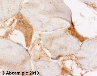 Immunohistochemistry (Formalin/PFA-fixed paraffin-embedded sections) - Anti-NBR1 antibody [5C3] (AB55474)