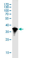 Western blot - Anti-NBR1 antibody [5C3] (AB55474), expandable thumbnail