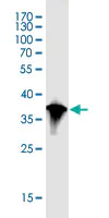 Western blot - Anti-NBR1 antibody [5C3] (AB55474)