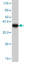 Western blot - Anti-NBR1 antibody [5C3] (AB55474), expandable thumbnail