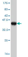 Western blot - Anti-NBR1 antibody [5C3] (AB55474)