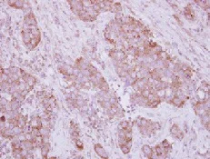 Immunohistochemistry (Formalin/PFA-fixed paraffin-embedded sections) - Anti-NBR1 antibody (AB126175)