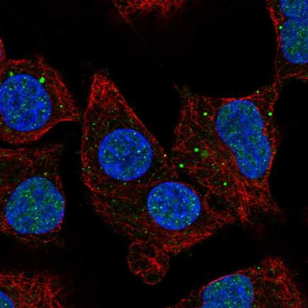 Immunocytochemistry/ Immunofluorescence - Anti-NBR1 antibody (AB219862), expandable thumbnail