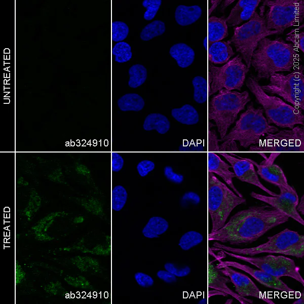 Immunocytochemistry/ Immunofluorescence - Anti-NBR1 antibody [EPR30441-637] (AB324910)