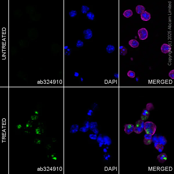 Immunocytochemistry/ Immunofluorescence - Anti-NBR1 antibody [EPR30441-637] (AB324910)